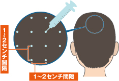 施術方法