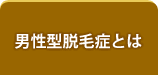 男性型性脱毛症とは