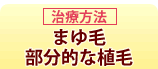 まゆ毛・部分的な植毛